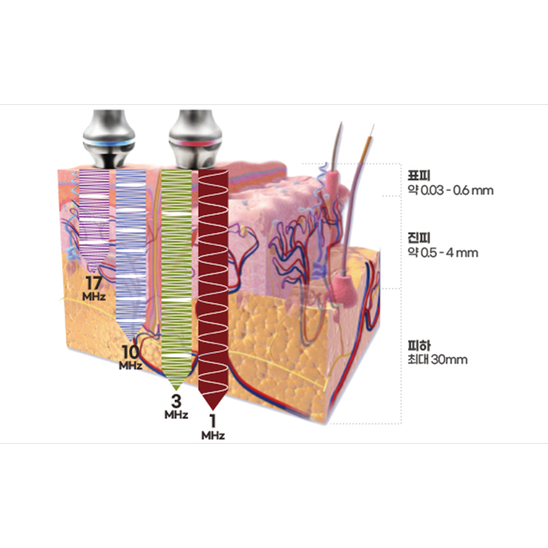 2 in 1 Wrinkle Removal Skin Rejuvenatien Cellulite Reduction Beauty Machine - Image 4